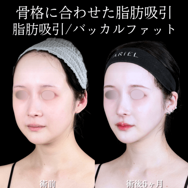 No.16865の症例写真2