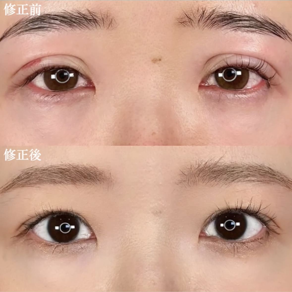 ハム目の症例写真