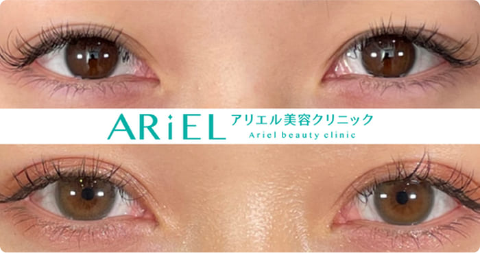 アリエル美容クリニックの症例写真