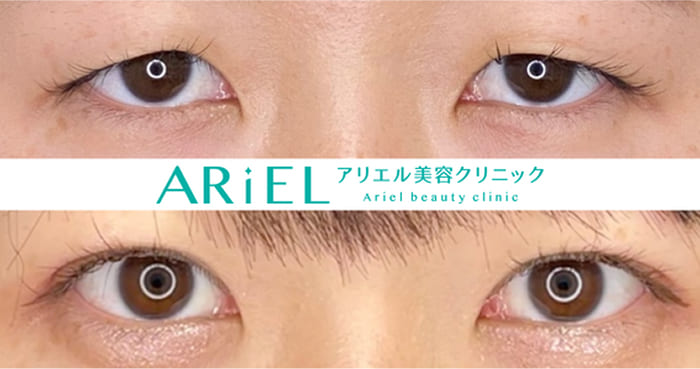 アリエル美容クリニックの症例写真
