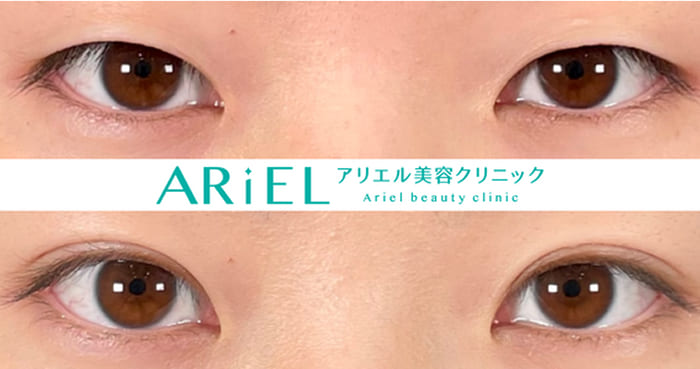 アリエル美容クリニックの症例写真