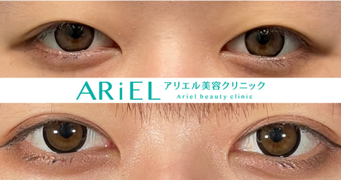 アリエル美容クリニックの症例写真