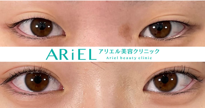 アリエル美容クリニックの症例写真